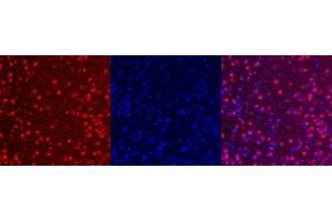 Immunohistochemistry (IHC) image for anti-ISL LIM Homeobox 1 (ISL1) antibody (ABIN7456087) (ISL1 anticorps)