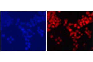 Immunofluorescence analysis of 293T cells using MonoMethyl-Histone H4-K20 Polyclonal Antibody (Histone H4 anticorps  (meLys20))
