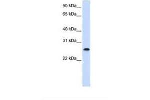 Image no. 1 for anti-PHD Finger Protein 19 (PHF19) (C-Term) antibody (ABIN6739281)