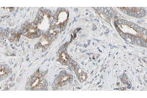 ABIN6276516 at 1/100 staining Human prostate tissue by IHC-P. (ARHGEF7 anticorps  (Internal Region))