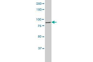 CLCN7 polyclonal antibody (A01), Lot # 060703JCS1 Western Blot analysis of CLCN7 expression in HL-60 .
