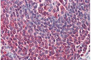 Human Spleen (formalin-fixed, paraffin-embedded) stained with TLR9 antibody ABIN364233 at 5-10 ug/ml followed by biotinylated anti-mouse IgG secondary antibody ABIN481714, alkaline phosphatase-streptavidin and chromogen.