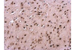 IHC-P Image VHL antibody detects VHL protein at cytosol and nucleus on mouse fore brain by immunohistochemical analysis.