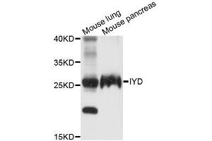 Western blot analysis of extracts of various cell lines, using IYD antibody (ABIN5996813) at 1/1000 dilution. (IYD anticorps)