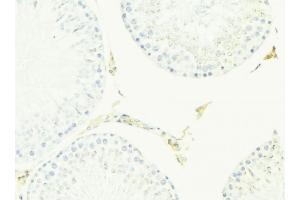 ABIN6276968 at 1/100 staining Mouse testis tissue by IHC-P. (ACPP anticorps  (Internal Region))