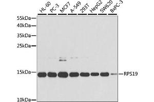 Western blot analysis of extracts of various cell lines, using RPS19 antibody (ABIN1874653) at 1:1000 dilution. (RPS19 anticorps)