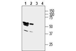 Western blot analysis of rat brain lysate (lanes 1 and 3) and mouse brain membranes (lanes 2 and 4): - 1,2. (GIPC1 anticorps  (Intracellular, N-Term))
