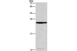 Western blot analysis of 231 cell, using GUK1 Polyclonal Antibody at dilution of 1:400