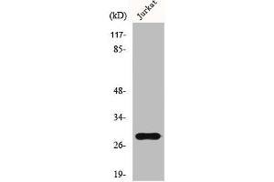 Western Blot analysis of Jurkat cells using GSTT1/4 Polyclonal Antibody (GSTT1 anticorps  (N-Term))