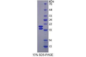 SDS-PAGE analysis of Rat Uromodulin Protein. (Uromodulin Protein (UMOD))