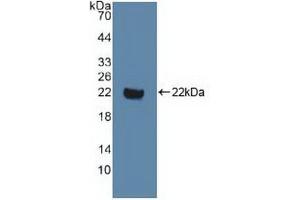 Western blot analysis of recombinant Human DVL1. (DVL1 anticorps  (AA 150-285))