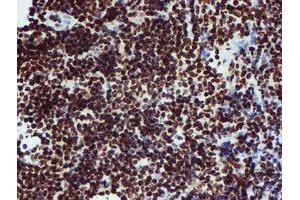 Image no. 2 for anti-Peptidyl Arginine Deiminase, Type IV (PADI4) antibody (ABIN1500017)