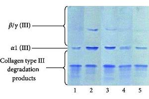 Western Blotting (WB) image for anti-Collagen, Type III (COL3) antibody (ABIN5596830)