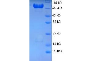 SDS-PAGE (SDS) image for Adaptor-Related Protein Complex 2, mu 1 Subunit (AP2M1) (AA 1-435), (full length) protein (GST tag) (ABIN5712071)