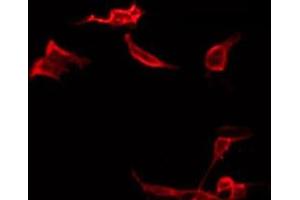ABIN6266572 staining LOVO by IF/ICC. (Cytokeratin 19 anticorps  (Internal Region))