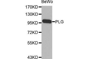 Western blot analysis of extracts of BeWo cell line, using PLG antibody. (PLG anticorps  (AA 20-300))