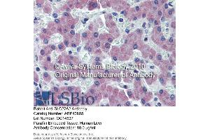 Immunohistochemistry (IHC) image for anti-Solute Carrier Family 27 (Fatty Acid Transporter), Member 2 (SLC27A2) (N-Term) antibody (ABIN405598) (SLC27A2 anticorps  (N-Term))
