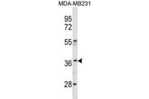 Western Blotting (WB) image for anti-Homeobox C10 (HOXC10) antibody (ABIN3001305) (HOXC10 anticorps)