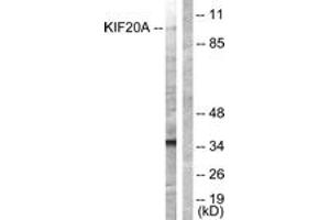 Western blot analysis of extracts from 293 cells, using KIF20A (Ab-528) Antibody. (KIF20A anticorps  (AA 501-550))