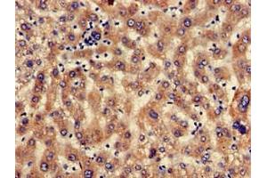 Immunohistochemistry of paraffin-embedded human liver tissue using ABIN7168659 at dilution of 1:100 (SEC23IP anticorps  (AA 779-989))