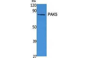 Western Blot (WB) analysis of specific cells using PAK5 Polyclonal Antibody.