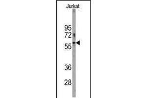 Western blot analysis of anti-PFKFB1 Antibody in Jurkat cell line lysates (35ug/lane). (PFKFB1 anticorps  (N-Term))