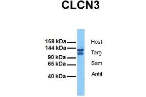 Host:  Rabbit  Target Name:  CLCN3  Sample Tissue:  Human 293T  Antibody Dilution:  1.