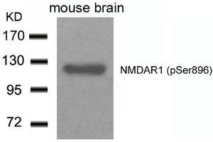 Western blot analysis of extracts from Mouse Brain tissue using NMDAR1(Phospho-Ser896) Antibody. (GRIN1/NMDAR1 anticorps  (pSer896))