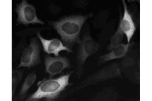 Immunofluorescent staining of HeLa (ATCC CCL-2) cells. (Cyclin B1 anticorps)