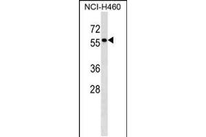 Western blot analysis in NCI-H460 cell line lysates (35ug/lane). (Tyrosinase-Related Protein 1 anticorps  (AA 341-371))