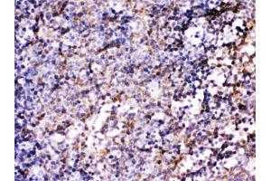 IHC testing of FFPE mouse lymph node with BCAR3 antibody. (BCAR3 anticorps)