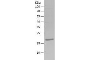 Western Blotting (WB) image for Estrogen Receptor 1 (ESR1) (AA 2-170) protein (His tag) (ABIN7122818) (Estrogen Receptor alpha Protein (AA 2-170) (His tag))