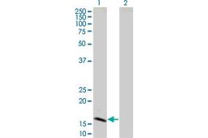 Lane 1: IFNB1 transfected lysate ( 22. (IFNB1 293T Cell Transient Overexpression Lysate(Denatured))