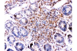 Anti-Bid Picoband antibody,  IHC(P): Rat Intestine Tissue (BID anticorps  (AA 1-195))