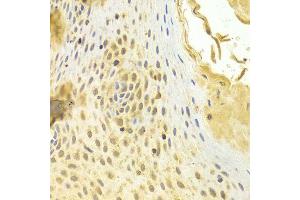 Immunohistochemistry of paraffin-embedded human esophageal using MAD2L1 antibody at dilution of 1:100 (x400 lens). (MAD2L1 anticorps)