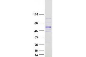 Validation with Western Blot
