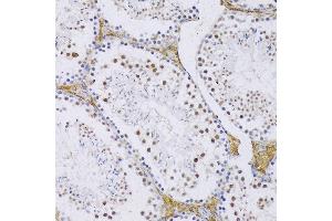 Immunohistochemistry of paraffin-embedded Mouse testis using SRSF3 antibody (ABIN6132649, ABIN6148465, ABIN6148466 and ABIN6221693) at dilution of 1:100 (20x lens).