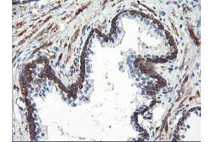 Image no. 5 for anti-phosphofructokinase, Platelet (PFKP) antibody (ABIN1500164)