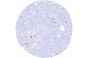 Pancreas Strong somatostatin positivity of a subset of pancreatic islet cells