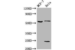 Western Blot Positive WB detected in: MCF-7 whole cell lysate, Hela whole cell lysate All lanes: SLC45A2 antibody at 5. (SLC45A2 anticorps  (AA 1-46))