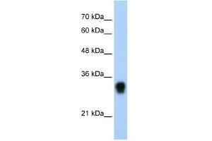 WB Suggested Anti-RPL8 Antibody Titration:  0. (RPL8 anticorps  (C-Term))