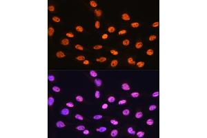 Immunofluorescence analysis of C6 cells using hnRNP K Rabbit mAb (ABIN7267634) at dilution of 1:100 (40x lens). (HNRNPK anticorps)