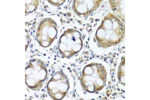Immunohistochemistry of paraffin-embedded human colon using IFI44 antibody (ABIN6135120, ABIN6142168, ABIN6142169 and ABIN6224213) at dilution of 1:100 (40x lens).