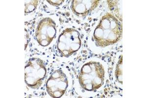 Immunohistochemistry of paraffin-embedded human colon using IFI44 antibody (ABIN6135120, ABIN6142168, ABIN6142169 and ABIN6224213) at dilution of 1:100 (40x lens). (IFI44 anticorps)