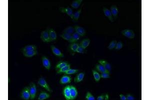 Immunofluorescent analysis of HepG2 cells using ABIN7171887 at dilution of 1:100 and Alexa Fluor 488-congugated AffiniPure Goat Anti-Rabbit IgG(H+L)