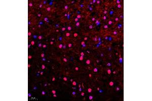 Immunofluorescence of paraffin embedded mouse brain using Api5 (ABIN7073094) at dilution of 1:400 (400x lens) (Apoptosis Inhibitor 5 anticorps)