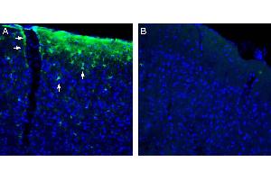 Expression of HCAR1 in mouse parietal cortex. (G Protein-Coupled Receptor 81 (GPR81) Peptide)