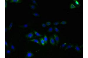 Immunofluorescent analysis of HepG2 cells using ABIN7175622 at dilution of 1:100 and Alexa Fluor 488-congugated AffiniPure Goat Anti-Rabbit IgG(H+L)