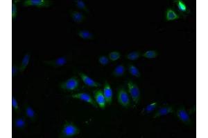 Immunofluorescent analysis of HepG2 cells using ABIN7175622 at dilution of 1:100 and Alexa Fluor 488-congugated AffiniPure Goat Anti-Rabbit IgG(H+L) (LRRC8E anticorps  (AA 353-630))