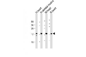 All lanes : Anti-MYL2 Antibody (Center) at 1:2000 dilution Lane 1: Human heart lysate Lane 2: Human skeletal muslce lysate Lane 3: Mouse heart lysate Lane 4: Rat heart lysate Lysates/proteins at 20 μg per lane.